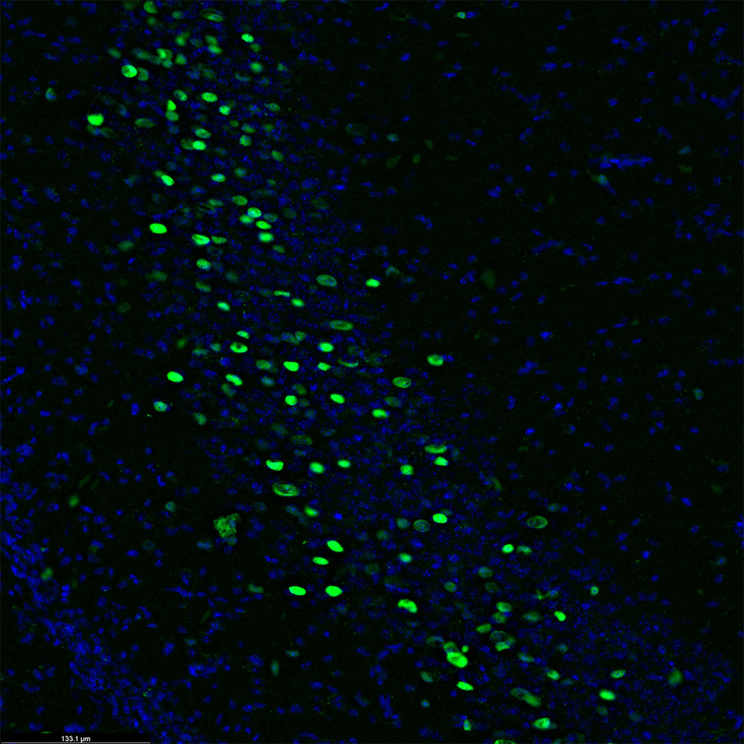 Boston University's Meyer Lab used our Aivia #AI Image Analysis Software to count the number of cells in mice brain tissue expressing cFos to measure the ability to inhibit a fear response in male and female mice. meyerlabneuro.com @buCSNneuro @heidithmeyer @BU_Tweets