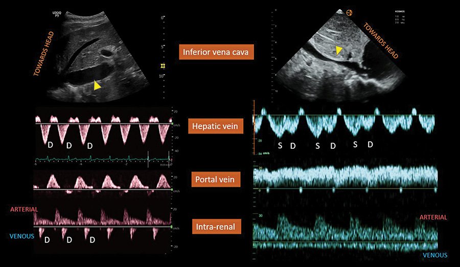 🔴  Diagnosis of Fluid Overload: From Conventional to Contemporary Concepts 
  #openaccess  #Review

karger.com/crm/article/12…
 #FOAMed #MedEd #medstudent #paramedic #Cardiology #CardioEd #medtwitter #meded #CardioTwitter #cardiotwiteros  #MedX #cardiovascular #MedTwitter #medical
