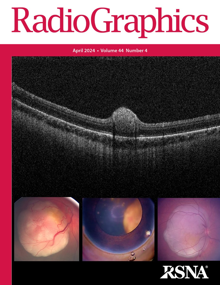 The latest issue of @RadioGraphics is now available! Check out the April issue here. bit.ly/NewRadG #RGphx #RadCME #RadRes