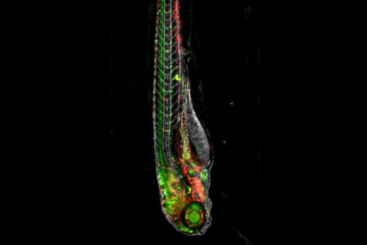 Hui Feng of @BUMedicine uses zebrafish to study tumor progression. In a recent @ScienceAdvances study co-authored by IPI she used an IPI #NCAM1 recombinant #antibody to help see how #naturalkillercells act in #MYCN-mediated #neuroblastoma. Read more! proteininnovation.org/2024/03/ipi-an…