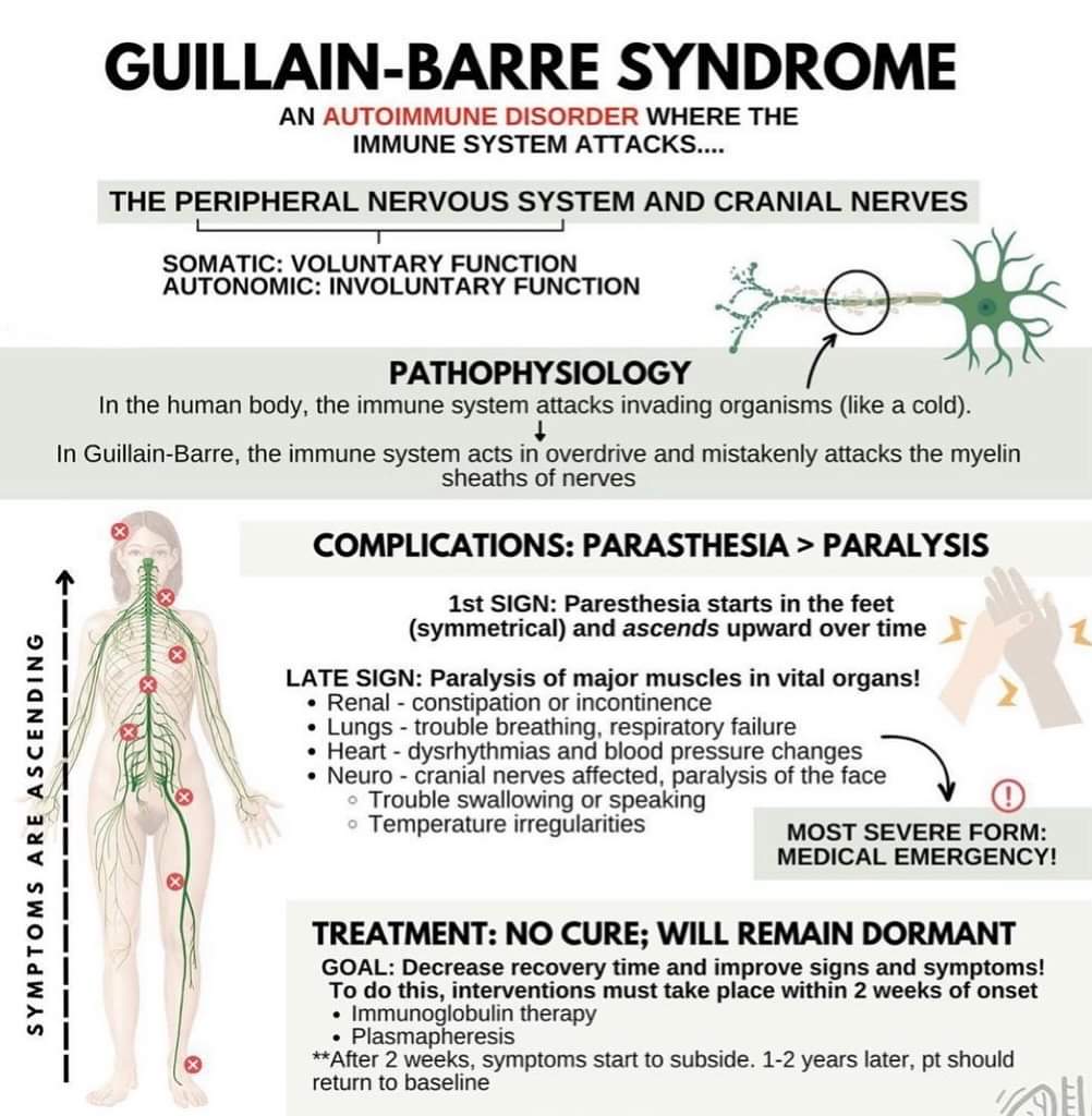 GBS Guillain barre syndrome