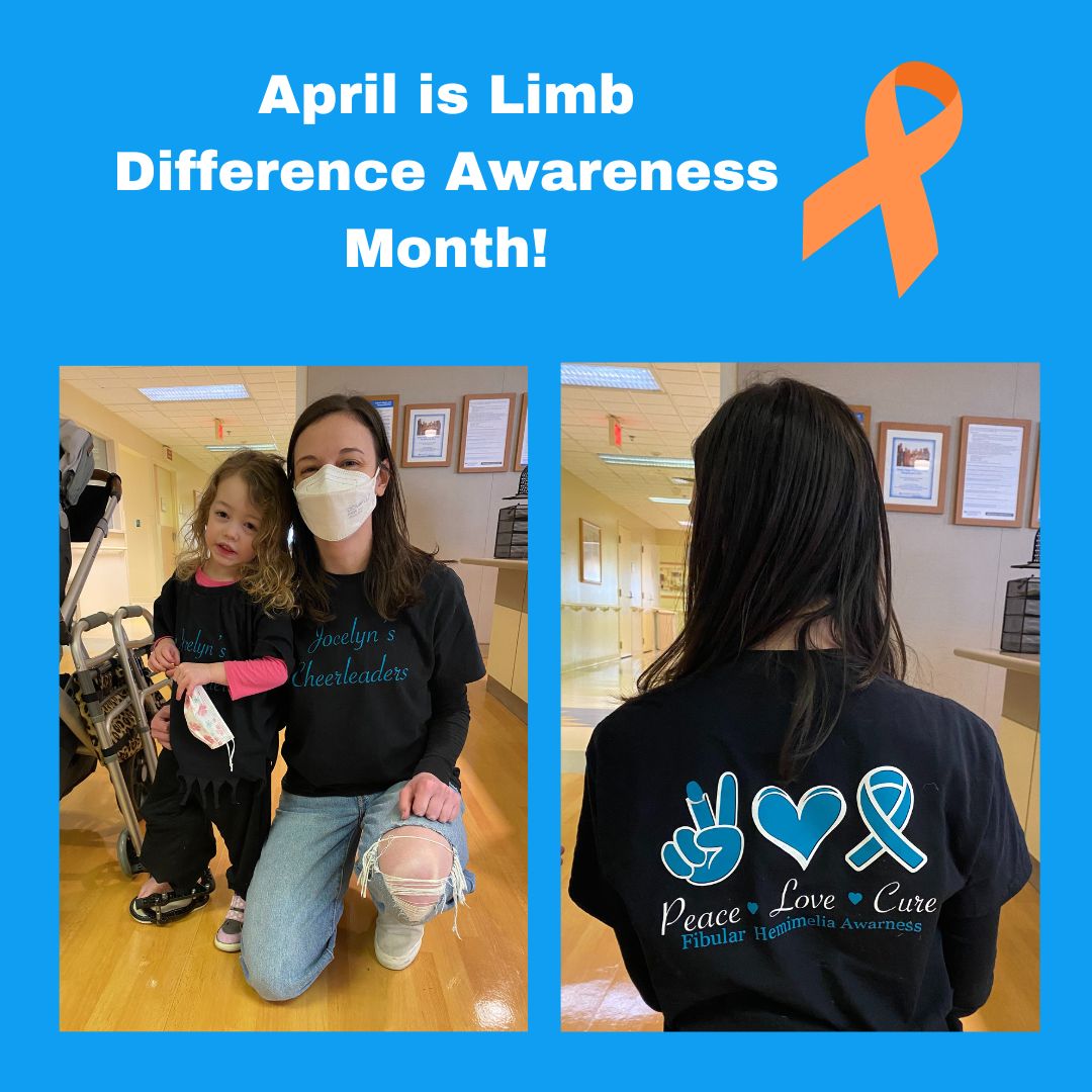 LimbLengthMD's tweet image. Did you know it is Limb Loss &amp;amp; #LimbDifferenceAwareness Month? Jocelyn’s class made these great shirts to raise awareness about #FibularHemimelia. We join them in cheering on Jocelyn and all our patients living with #LimbDifferences who show amazing strength &amp;amp; resilience!  #ICLL