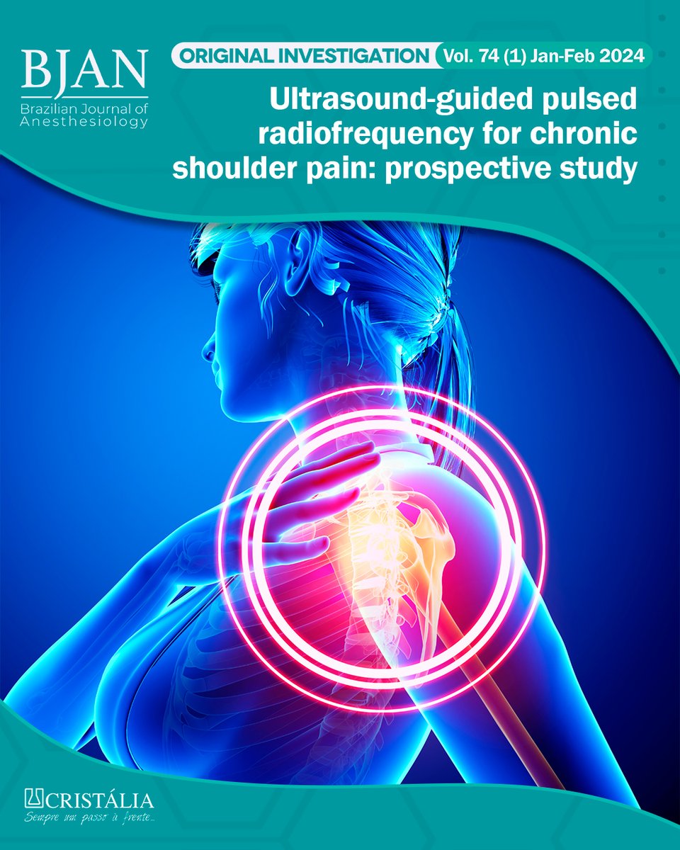 📌 Check out the complete results: bit.ly/USPAIN #joinBJAN #citeBJAN #anesthesiology #sba #anestesiologista #anesthesia #ultrasonography #shoulderpain #pain