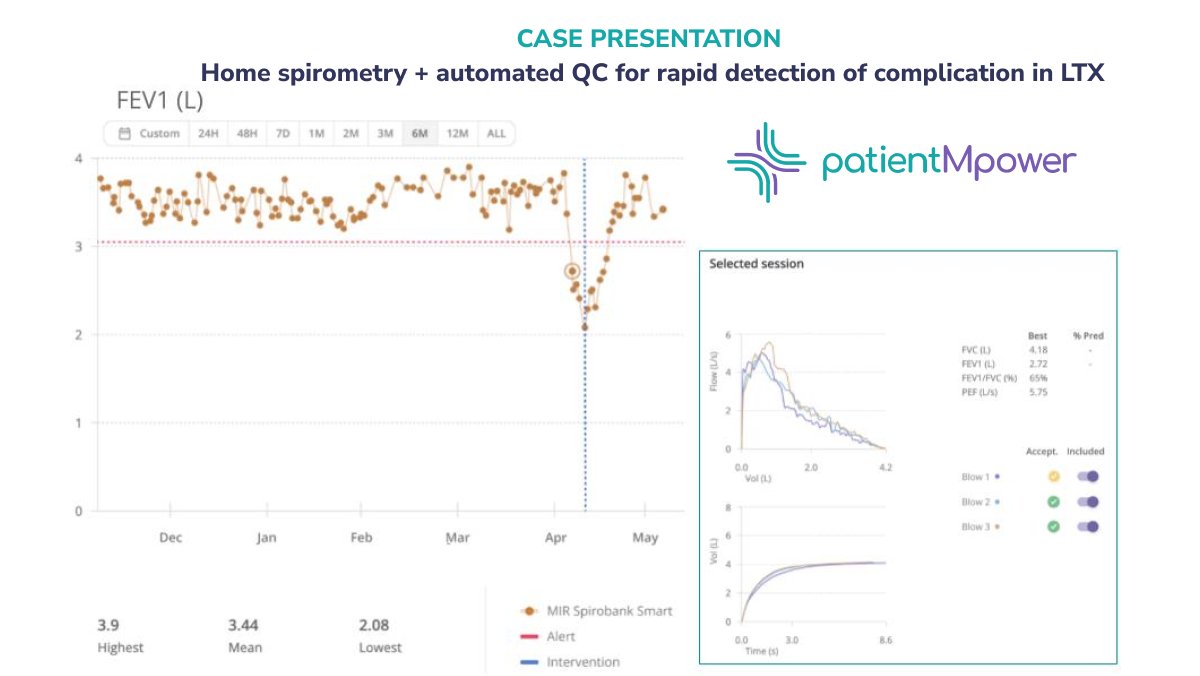 A real world case of identification of infection in #LungTransplant using our technology FEV1 trend (left), with 'real' decline confirmed by integrated spirometry QC (right) Early and successful management w/o admission 🙌 More at #ISHLT24 - get in touch to meet us in Prague!