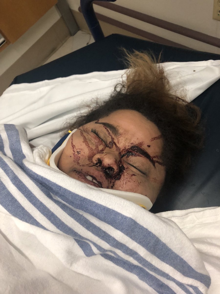 KaylaStruckxo's tweet photo. PSA ๐ฃ๏ธ FUCK DRUNK DRIVERS . This is a result of some one drinking & driving. #STOPDRINKINGANDDRIVING https://t.co/uGQLRUilgg
