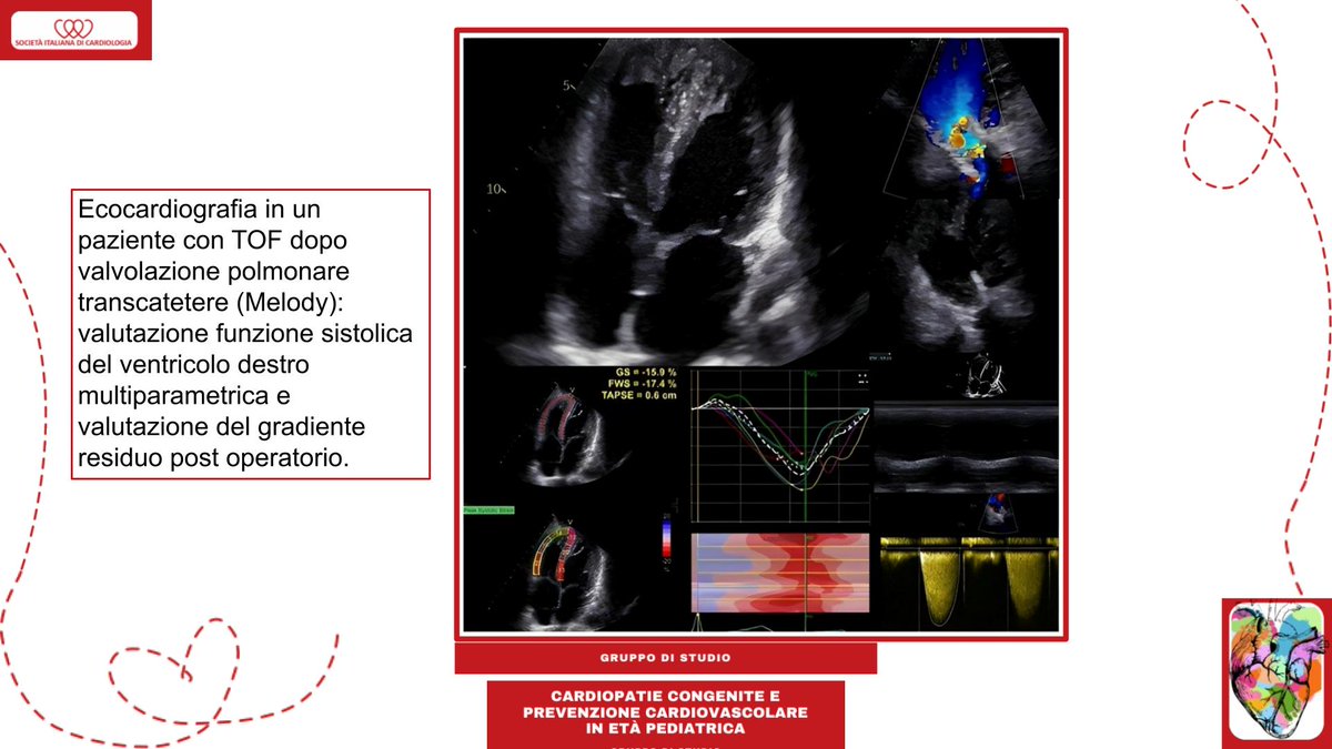 SIC_CARDIOLOGIA tweet picture