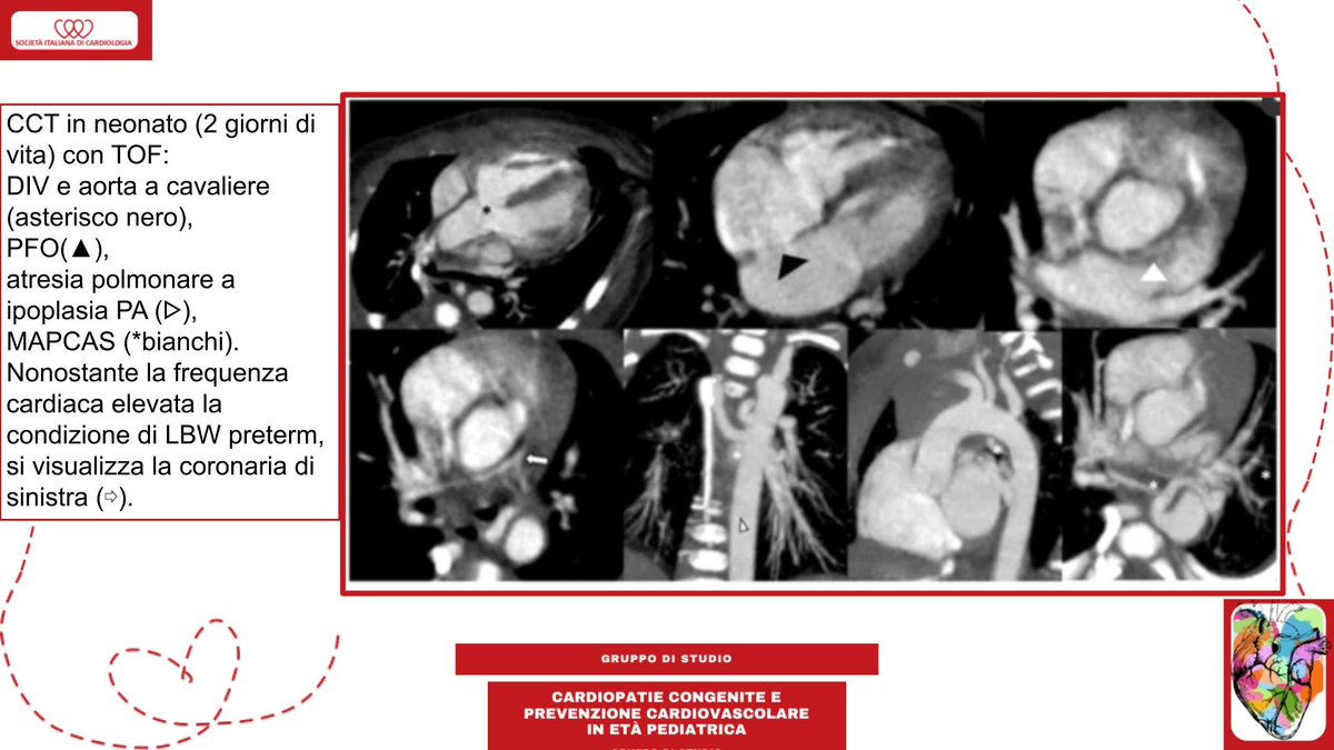 SIC_CARDIOLOGIA tweet picture