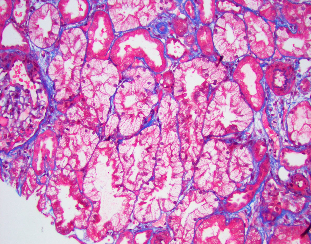 JZRenalPath tweet picture