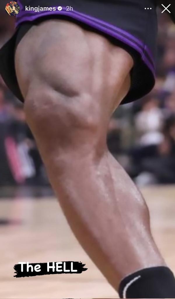 LeBron James posted this picture of his leg muscle on his Instagram story  🤣 “Maybe I should lay off leg day 1 day this week!” (via @KingJames / IG)
