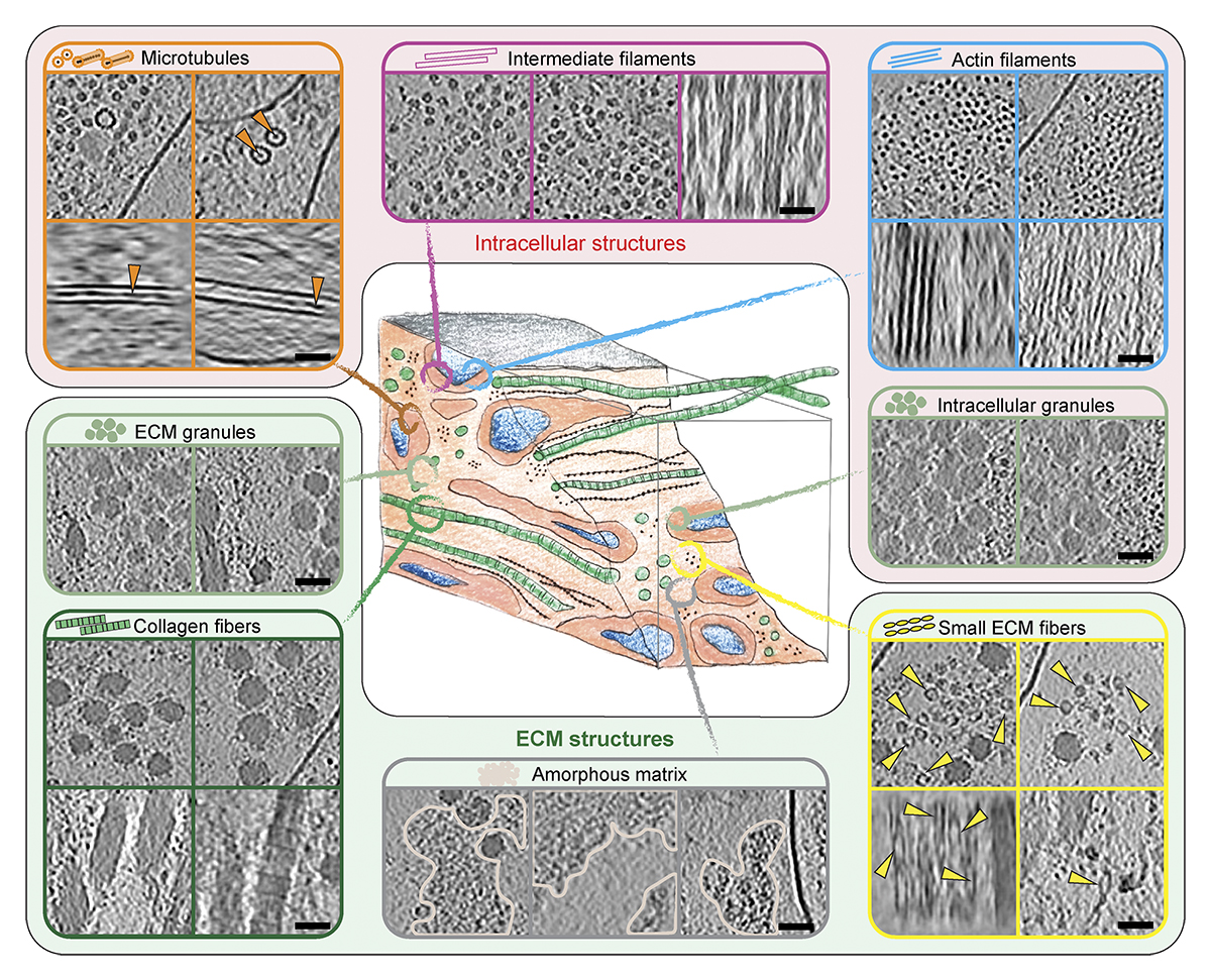 Journal of Cell Biology (@jcellbiol) on Twitter photo Image shows details of extra- and intracellular structures found in cell-derived matrix tomograms. <a href="/BettinaZens/">Bettina_Zens</a> et al. @SchurLab <a href="/ISTAustria/">ISTAustria</a> present a workflow to structurally characterize natively preserved #ECM using lift-out cryo-FIBSEM and cryo-ET. hubs.la/Q02rFTZw0 Image shows details of extra- and intracellular structures found in cell-derived matrix tomograms. <a href="/BettinaZens/">Bettina_Zens</a> et al. @SchurLab <a href="/ISTAustria/">ISTAustria</a> present a workflow to structurally characterize natively preserved #ECM using lift-out cryo-FIBSEM and cryo-ET. hubs.la/Q02rFTZw0