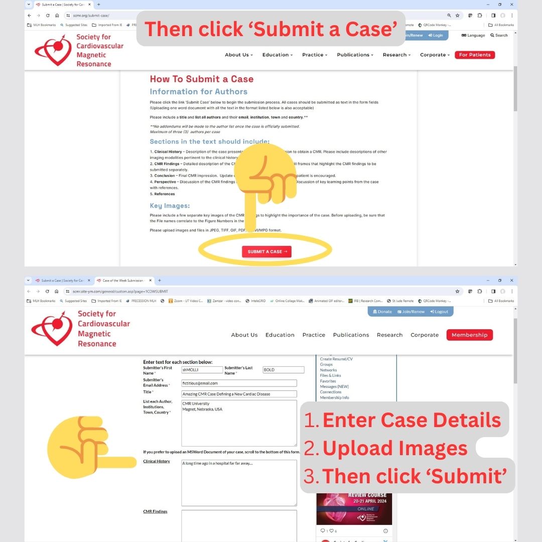 📣Submit #WhyCMR cases to Cases of @SCMRorg today! scmr.org/submit-case/ ✅Excellent way for learners to get exposure to CMR ✅All accepted cases published in @journalofCMR 🏅Top cases present at SCMR Scientific Sessions 1⃣One case voted best Cases of SCMR 2024 #SCMRCases