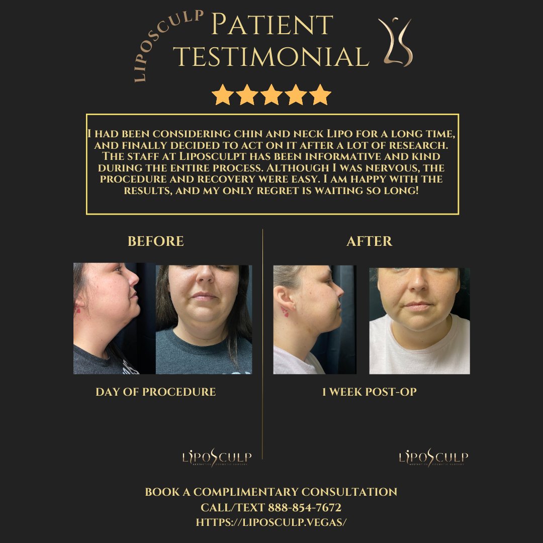 LipoSculp's tweet photo. Real stories, real transformations: Witness the incredible transformation and newfound confidence in every step through our patients' testimonials. https://t.co/DuZ81vrffd