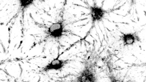 A @UWSCRMC @uwsmph @UWMadison_BME collaboration developed a new tool combining autofluorescence and single-cell RNA sequencing to study neural stem cell behavior. Technique to aid in the study of adult neurological diseases and aging. stemcells.wisc.edu/2024/03/27/new…