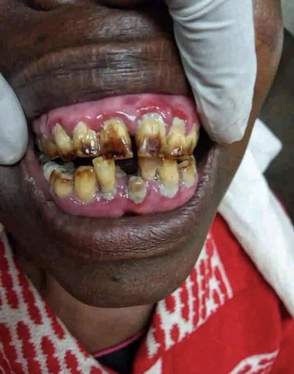 Bigthimz's tweet photo. Ladies, will you kiss this man for 10m https://t.co/eFJ5kyVYC6