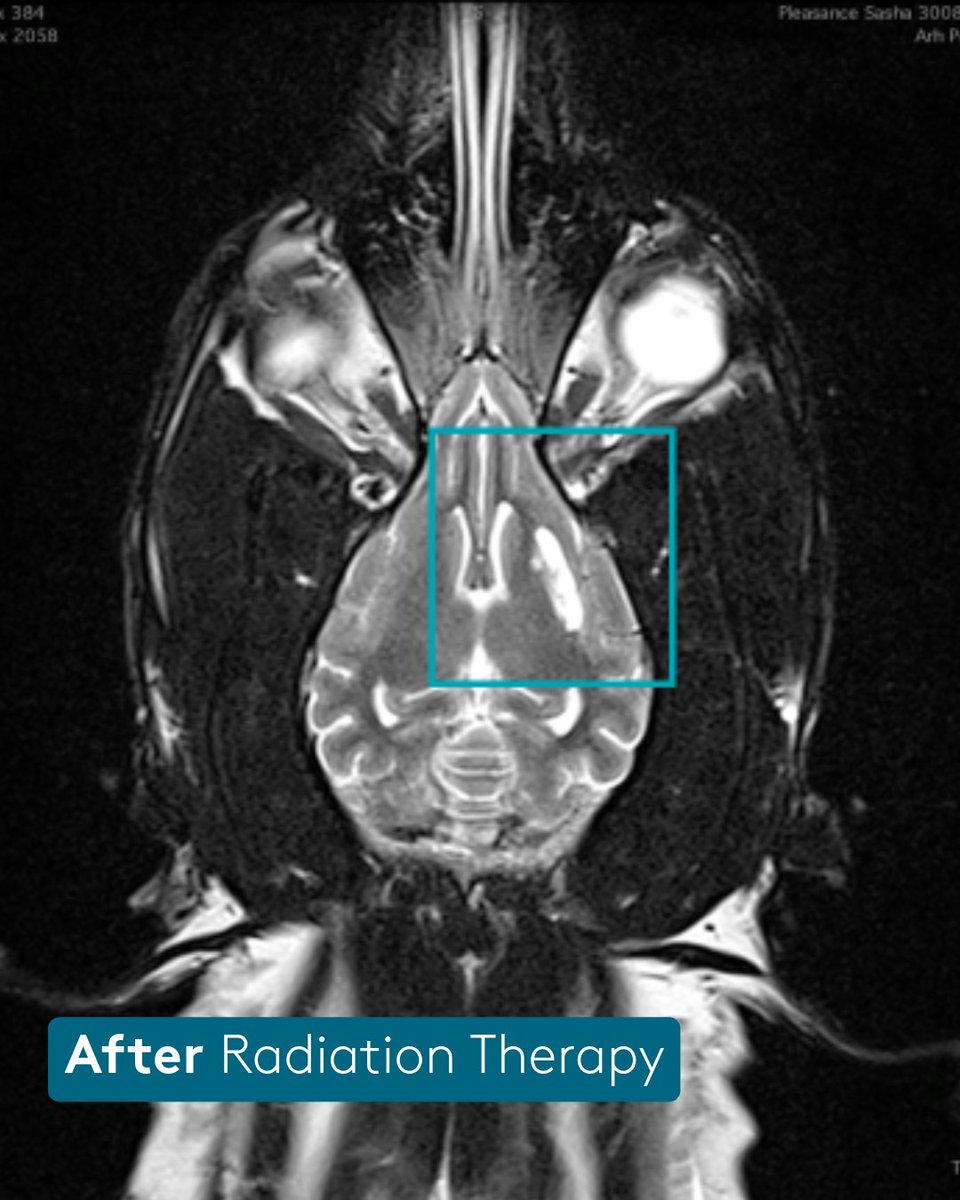 Sasha is a cattle 🐶 that was treated with SRT for a left forebrain glioma ~two years ago. As you can see from the post-Tx scan, she responded well. Read how her #vetonc team works to save and prolong the lives of four-legged friends with #petcancer 🐾➡️ bit.ly/46oIlIt