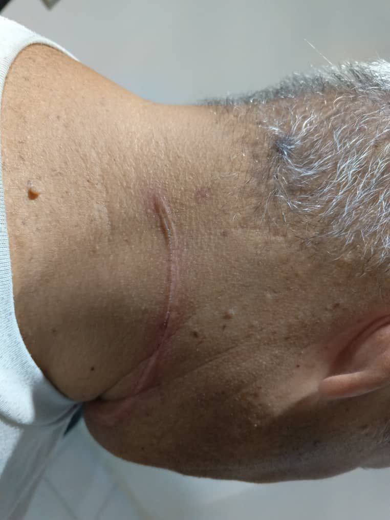 InforTvenezuela's tweet image. Denuncia

Un grupo de delincuentes están colocando guayas para robar a los motorizados a la altura de la Viga de tránsito de la Urbanización Lomas del Avila, hacia Filas de Mariche.
Petare, municipio Sucre. 
#Caracas #Cicpc