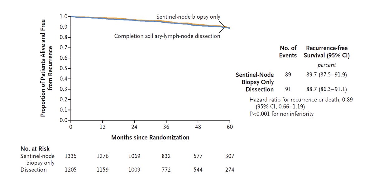 Patients with sentinel-node metastasis at the time of breast-cancer surgery may undergo axillary dissection to remove more nodes, which can lead to side effects. In a trial, the additional surgery did not prolong survival. Full SENOMAC trial results: nej.md/3PNRGD9