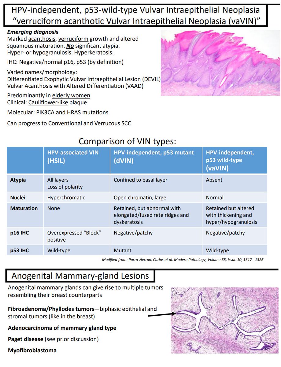 I just updated many of the GYN notes on my teaching website, 'Kurt's Notes' (kurtsnotes.net) to incorporate newer entities/findings and some things I'd overlooked before. 🔬🔬🔬🔬🔬🔬🔬🔬🔬🔬🔬🔬🔬🔬🔬🔬🔬🔬🔬🔬🔬🔬🔬🔬🔬🔬🔬🔬🔬🔬🔬🔬