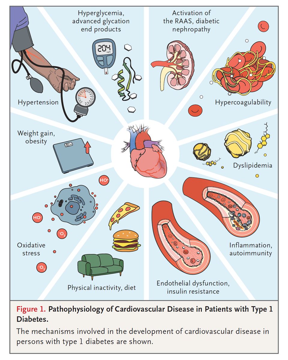 More than half of newly diagnosed cases of type 1 diabetes occur in adulthood. A new review focuses on the prevention of cardiovascular disease in patients with type 1 diabetes. Read the full review: nej.md/43J9XqZ