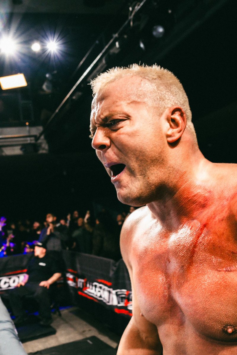 Jason Christopher's chest after his @HailtheUCS wasn't great, but the victory sure was.