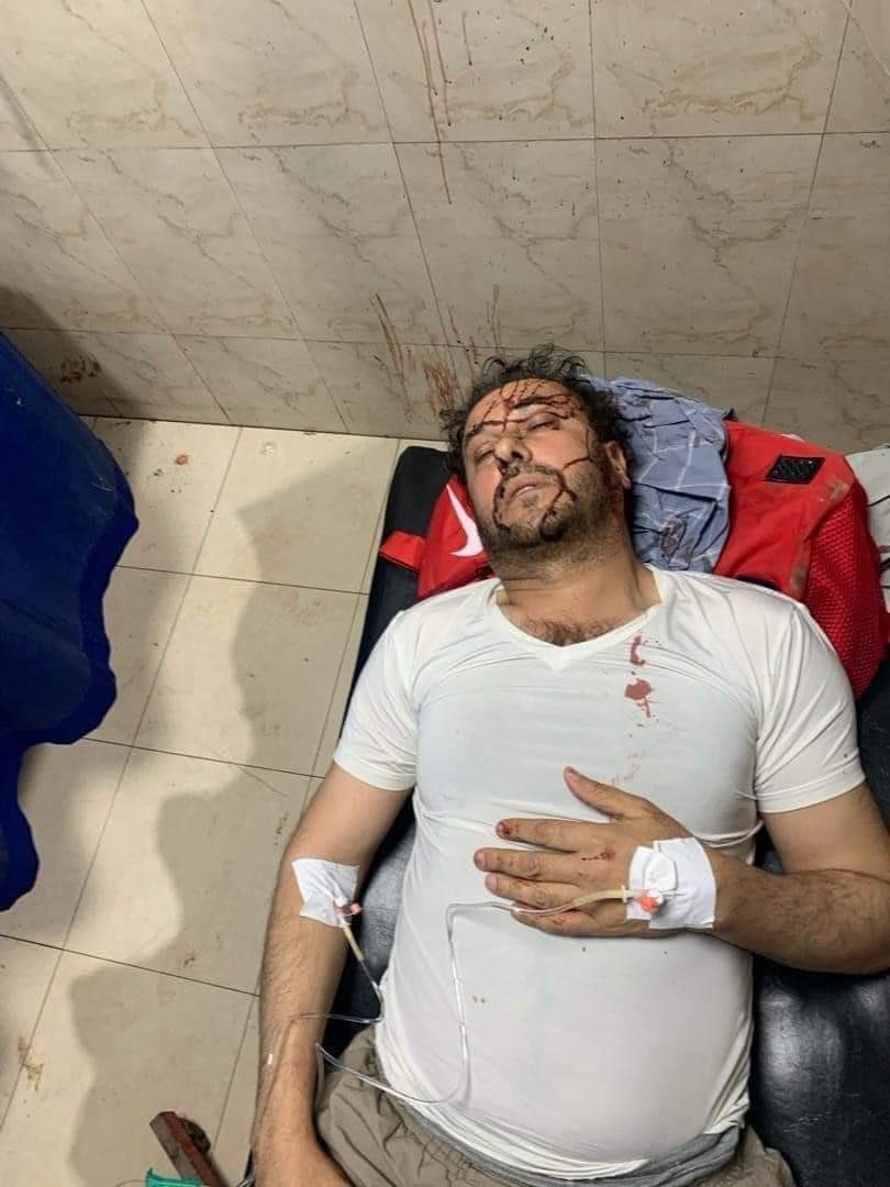 🚨 Afghan journalist Ahmad Hanayesh, affiliated with Radio Azaadi, Dunya, Kahkisha radio, and a member of the Pak-Afghan Journalists Union, survived an assassination attempt in #Islamabad. Last night, around 12:00 am, while on his way home in the G-6 Embassy Road area, he was