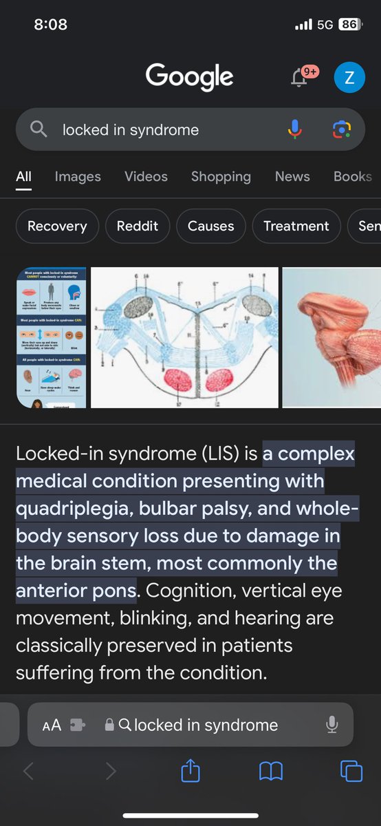zsiskind's tweet photo. Just got back from the doctor. Got diagnosed with https://t.co/n5321BITU1