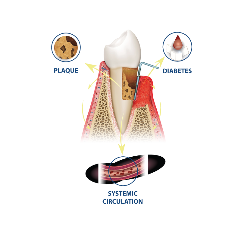SMLGlobal's tweet photo. THE GATEWAY TO ORAL HEALTH:  PROTECTING THE HEART AT THE SOURCE OF HARM
 those suffering from gum disease are two to three times more susceptible to heart attack, stroke or other serious cardiovascular event.

https://t.co/vl9dLTvnpf https://t.co/p12dUd478O