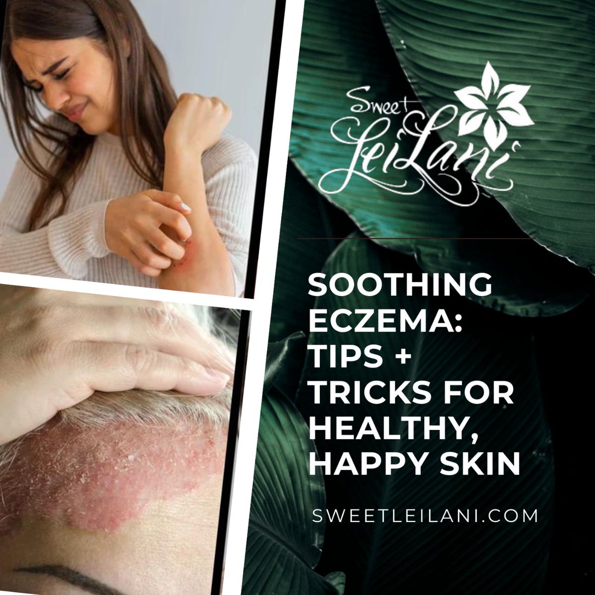 Soothing #Eczema: Tips & Tricks For Healthy, Happy Skin

Expert #skincaretips + #makeuphacks for #sensitiveskin: Keep your skin hydrated, choose the right products & navigate makeup applications without aggravating flare-ups. 👉 bit.ly/49id8Hu

#sweetleilanicosmetics