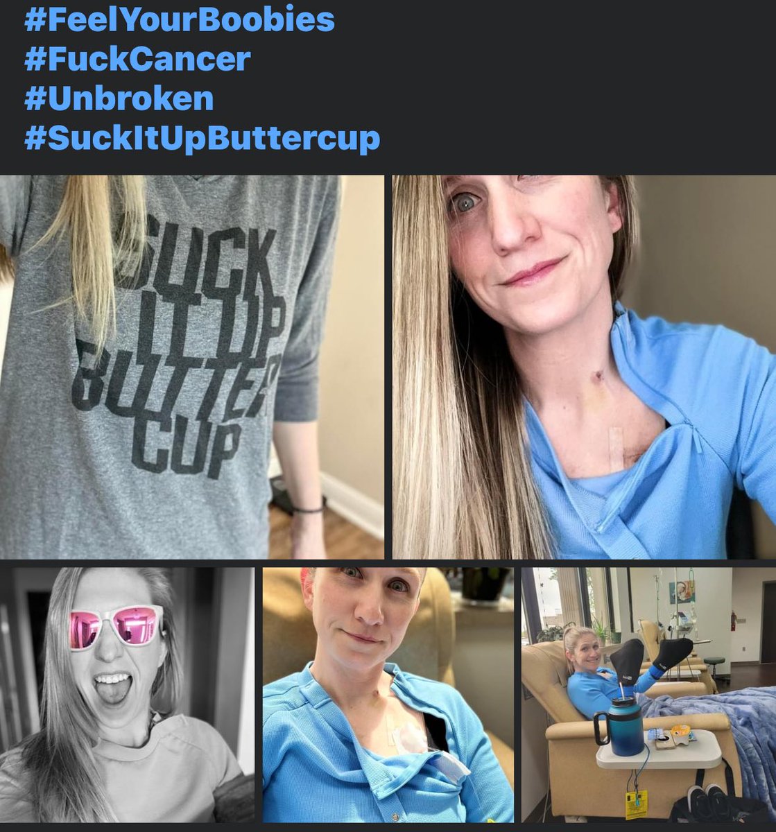 A year ago today, I started my first round of chemo. Today, I stand #CancerFree. 

Be fearless in your struggles. Always maintain a sense of humor and remember… “It could always be worse.” 

#FuckCancer
#BreastCancer