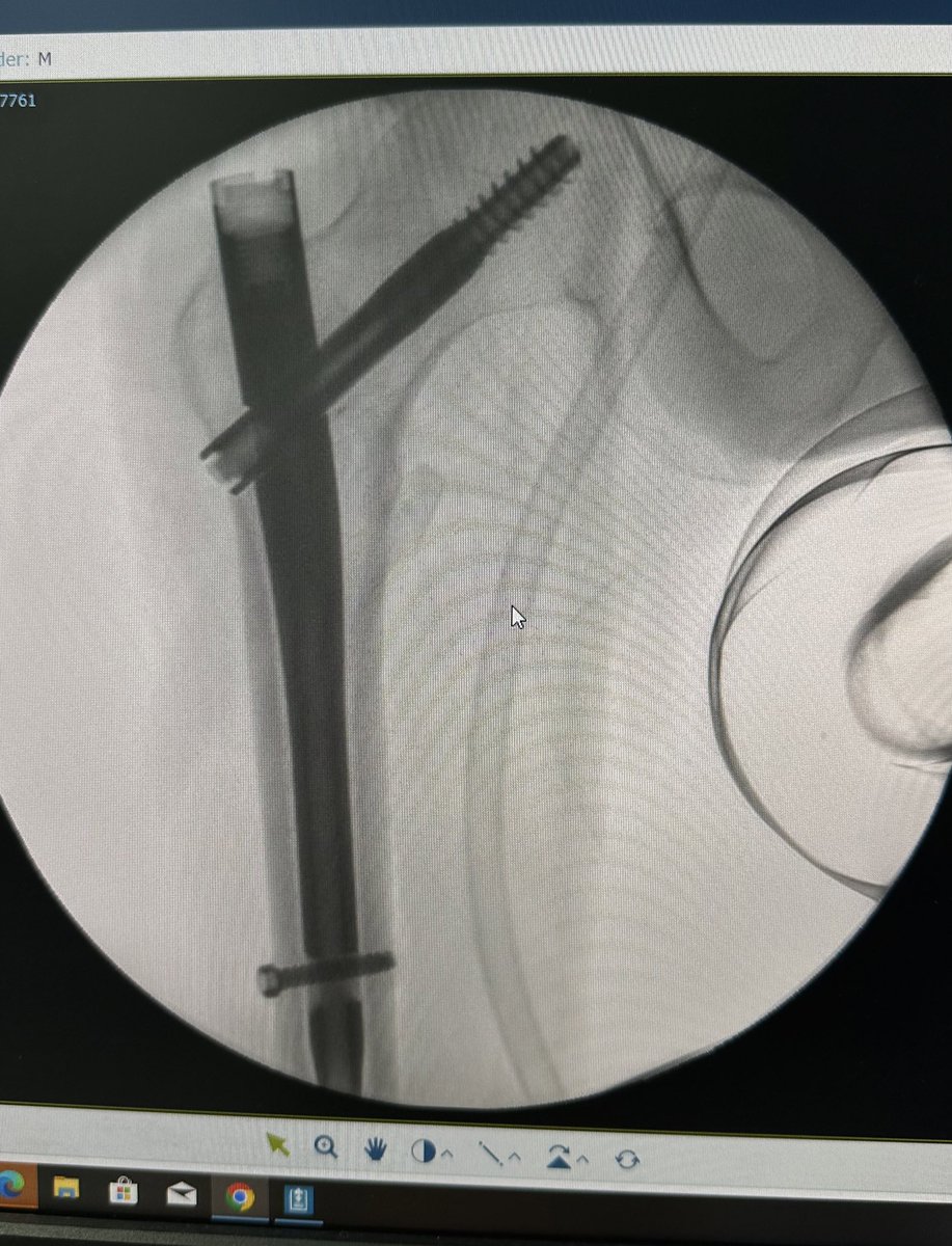 <a href="/RAD_SA_TEAM/">الفريق الاشعاعي التطوعي</a> Different imaging modalities 🤏🏻✨