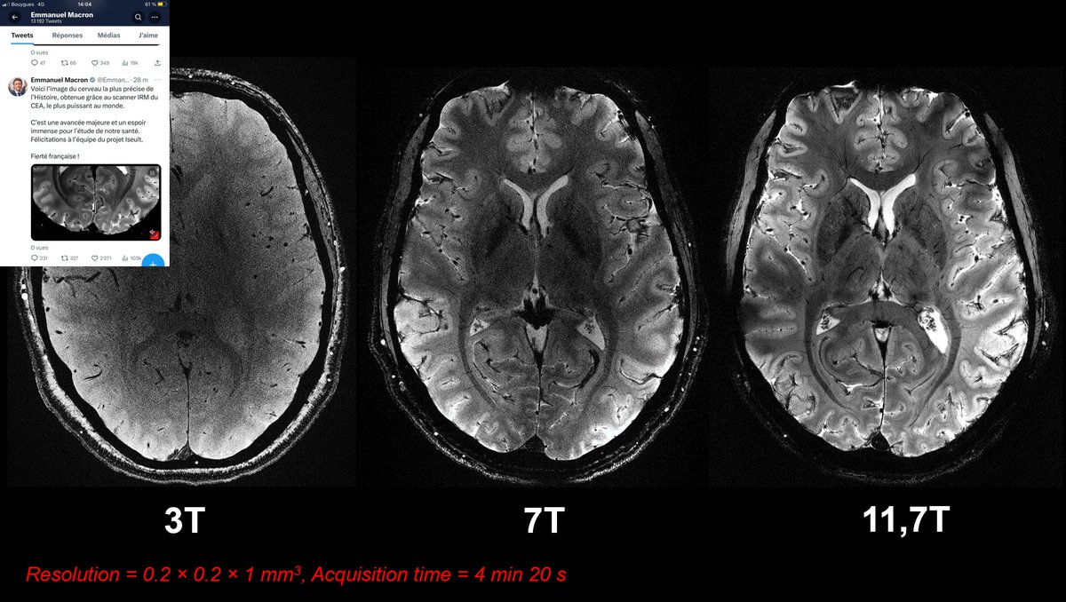 Press conference with the French minister of research <a href="/sretailleau/">Sylvie Retailleau</a> to reveal first in vivo images of the human brain acquired at 11.7T. Shown here at the same protocol acquisitions at 0.2x0.2x1.0mm3 resolutionsin 4' 20" at 3, 7 and 11.7T illustrating the gain in image quality.