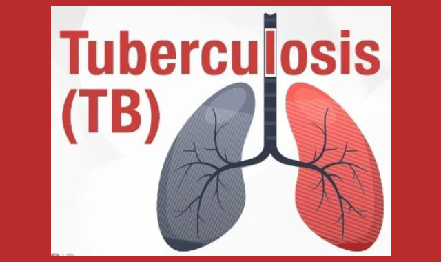India TB Report 2024: Progress, Challenges, and Strategies

Click here to read more - educationpost.in/news/education…

#IndiaTBReport #Tuberculosis #Healthcare #PublicHealth #MinistryOfHealth #FamilyWelfare #TBControl #HealthStatistics #DiseasePrevention #HealthPolicy #LatestNews #EPNews
