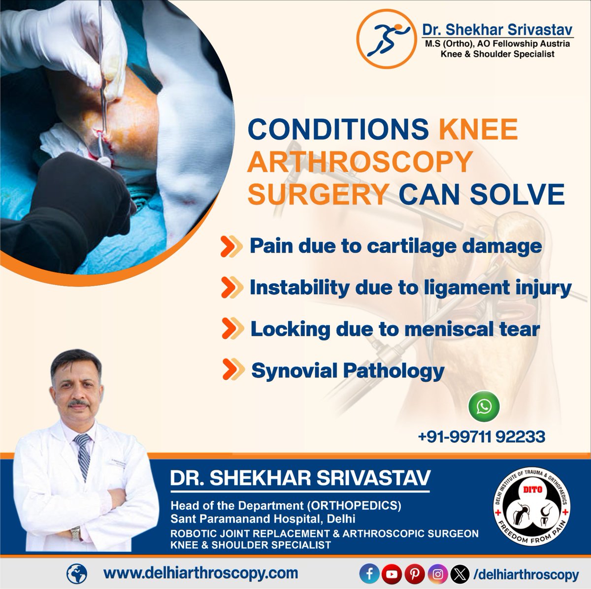 Discover a new lease on life with knee arthroscopy surgery by Dr. Shekhar Srivastav. Say goodbye to knee pain and hello to mobility!
#kneearthroscopy #kneereplacementsurgeon #robotickneereplacement #knee #joints #ortho #orthopedics #drshekharsrivastav