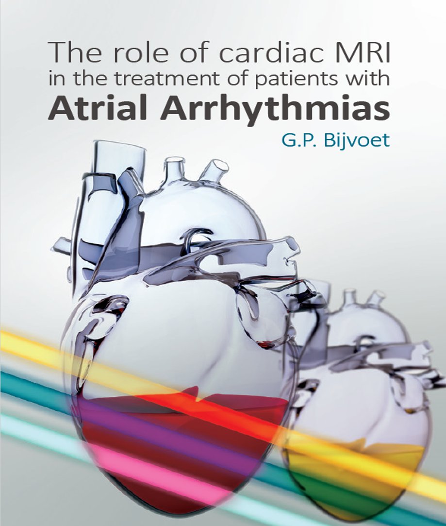 #thesisdefence Tomorrow, @MirandaBijvoet will defend the thesis 'The role of cardiac MRI in the treatment of patients with atrial arrhythmias' at 16:00h @MaastrichtU 📺youtube.com/live/LTxKJ5luq… #phdlife @kvernooy