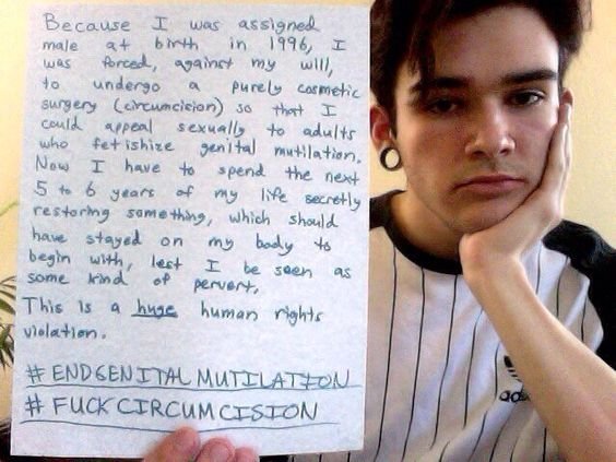 He wouldn't have to restore if he was left as whole as nature intended.

End genital mutilation of little boys.