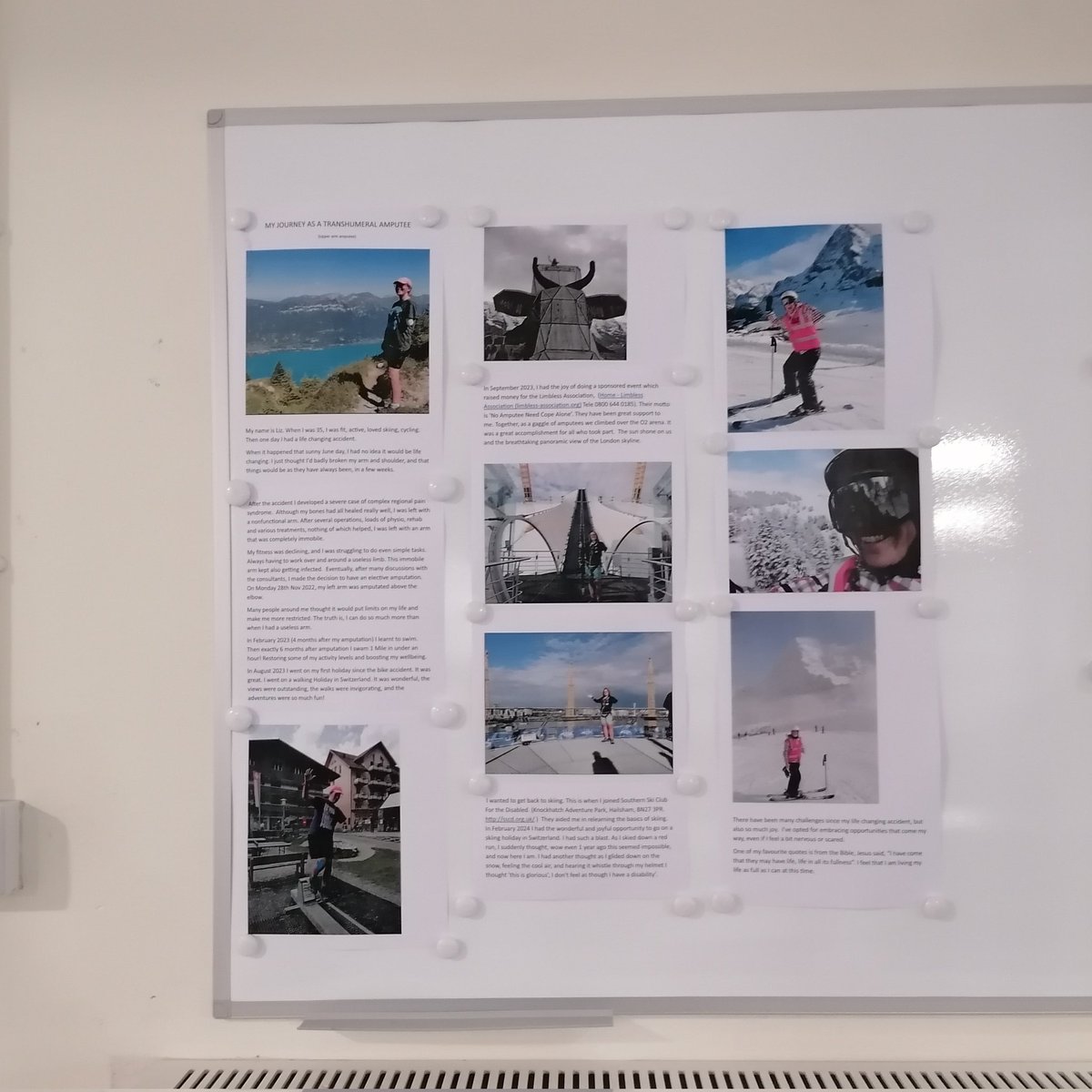 lizstyles's tweet image. It&apos;s #limbloss and #limbdifferenceawarenessmonth I&apos;ve coincidentally got an appointment at #prosthetics but check out the notice board... It&apos;s me! FUN! #llldaw #onearmonly #amputee