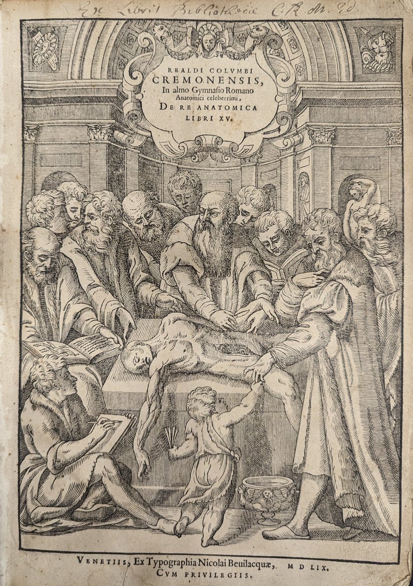 This 1559 frontispiece shows the author Colombo. He dedicated the final chapter of this work to the study of diseased organs, establishing the beginnings of morbid anatomy, or the pathology of diseased bodies

Check out the original in our exhibition rcpe.ac.uk/heritage/after…