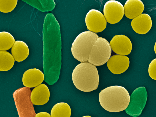 Biologie - UNIGE (@biologie_unige) on Twitter photo 📢New: opening of the #Microbiology specialization in our #Master in Biology. Our program will cover essential aspects of microbiology: environmental, medical, applied and fundamental 🧫🧪🧬🔬🦠
Find out more about our different orientations: unige.ch/sciences/biolo… <a href="/UNIGEnews/">Université de Genève</a> 📢New: opening of the #Microbiology specialization in our #Master in Biology. Our program will cover essential aspects of microbiology: environmental, medical, applied and fundamental 🧫🧪🧬🔬🦠
Find out more about our different orientations: unige.ch/sciences/biolo… <a href="/UNIGEnews/">Université de Genève</a>