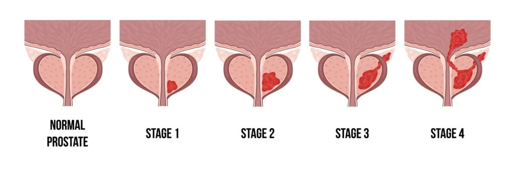 private_sono's tweet photo. Prostatitis: Causes, Symptoms, and Advanced Diagnosis and Treatment
Prostatitis, an inflammation of the prostate gland, affects men of all ages and can significantly impact quality of life. 

#prostatescan #prostateultrasound #Prostatitis

https://t.co/bSzY30mCc6 https://t.co/gN8KXqPWZZ