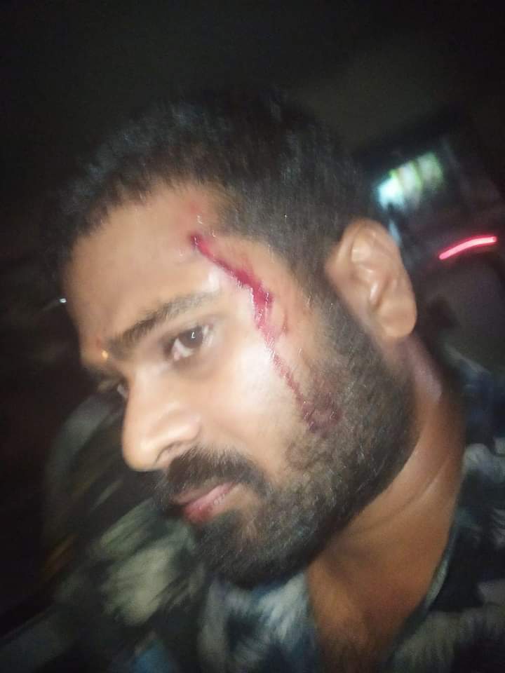 खबर संकलन करने जा रहे <a href="/TV45BJ/">TV45 - Bihar Jharkhand</a> के पत्रकार चित्तरंजन कुमार और कैमरामैन के साथ कांके रोड़ में मारपीट की गई है, रिपोर्टर के माथे पर चोट लगी है, घटना चाँदनी चौक के पास हुई है। <a href="/ranchipolice/">Ranchi Police</a> <a href="/ChampaiSoren/">Champai Soren</a> <a href="/yourBabulal/">Babulal Marandi</a> <a href="/DIG_Ranchi/">DIG Ranchi</a> कृपया मामले की जांच कर कार्रवाई की जाए।