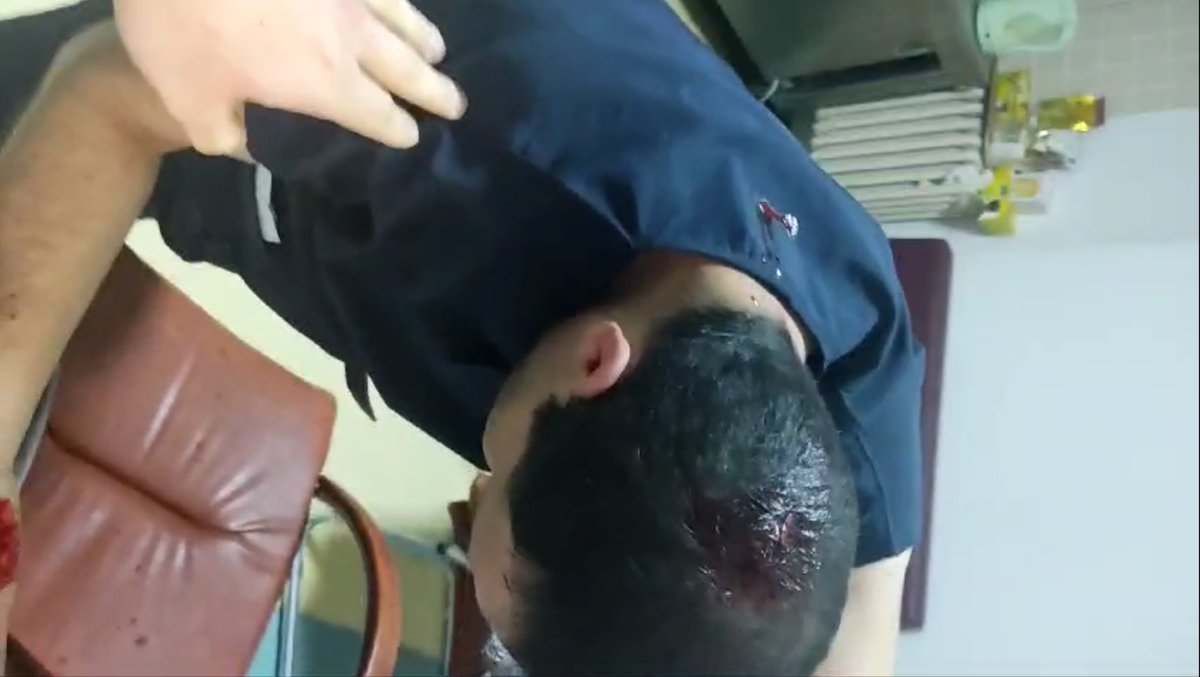 hemsireyizbiz_'s tweet photo. Tekirdağ Çorlu'da Protez ve Ortez Teknikeri arkadaşımıza hastanenin bir yöneticisi tarafından saldırı yapılmış. Bardakla kafasını yaralamış öldürmeye teşebbüs edilmiştir.

Şiddeti hâlâ çözüme kavusturmayanlardan sizce bakan yada yönetici olur mu? #sağlıktaşiddet https://t.co/5mEx1qZwNA