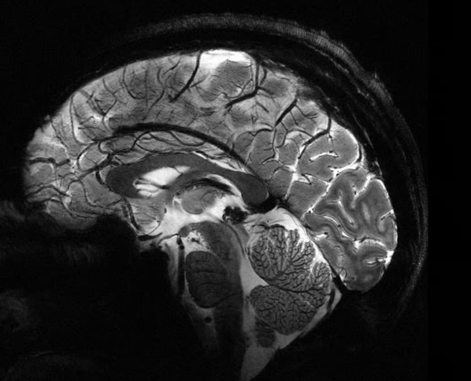 Most powerful MRI of brain yet. 11.7 Tesla newatlas.com/medical/powerf… @CEA_Officiel