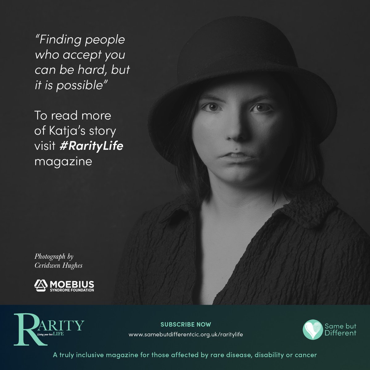 Katja’s first person account about her experiences of living with #moebiussyndrome and #facialpalsy is written with real openness & honesty, find it here: samebutdifferentcic.org.uk/raritylife #RarityLife #raredisease #moebiussyndrome #nationallotteryRead @MoebiusSyndrome @facialpalsyuk