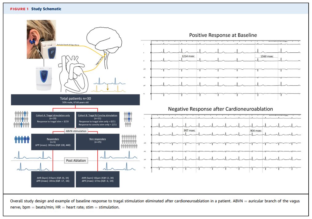 Timothy Markman (@dr_markman) on Twitter photo #EPeeps Cardioneuroablation has uncertain endpoints. Can non-invasive vagal stim assess efficacy? With <a href="/drhbkmd/">Balaram Krishna Hanumanthu</a> <a href="/PennEPFellows/">Penn Electrophysiology Fellowship</a> we studied stim of the auricular branch of vagus nerve from the tragus and cymba concha before and after CNA <a href="/JACCJournals/">JACC Journals</a> authors.elsevier.com/a/1isse,siTgkp… #EPeeps Cardioneuroablation has uncertain endpoints. Can non-invasive vagal stim assess efficacy? With <a href="/drhbkmd/">Balaram Krishna Hanumanthu</a> <a href="/PennEPFellows/">Penn Electrophysiology Fellowship</a> we studied stim of the auricular branch of vagus nerve from the tragus and cymba concha before and after CNA <a href="/JACCJournals/">JACC Journals</a> authors.elsevier.com/a/1isse,siTgkp…