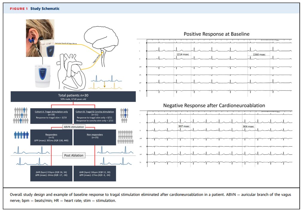 #EPeeps Cardioneuroablation has uncertain endpoints. Can non-invasive vagal stim assess efficacy? With @drhbkmd @PennEPFellows we studied stim of the auricular branch of vagus nerve from the tragus and cymba concha before and after CNA @JACCJournals authors.elsevier.com/a/1isse,siTgkp…