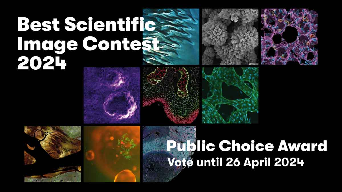 🌌 Dive into the beauty of science - cast your vote for the #HIBestImage24 & help decide this year's #HelmholtzImaging Public Choice Award! Which scientific image captivates you most? Vote now & spread the word: bit.ly/HIAwards2024 You have until 26 Friday 2024 to decide.