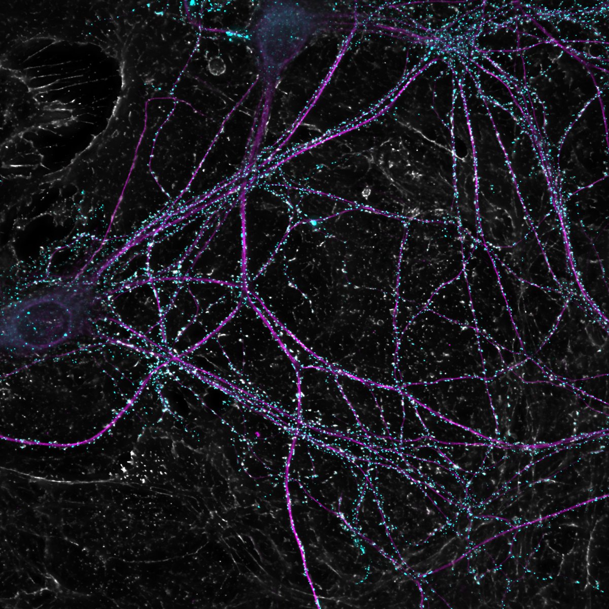DIV 21 hippocampal neurons (a bit overrun by glia) cyan- SynGAP1 magenta- Map2 grey- beta actin