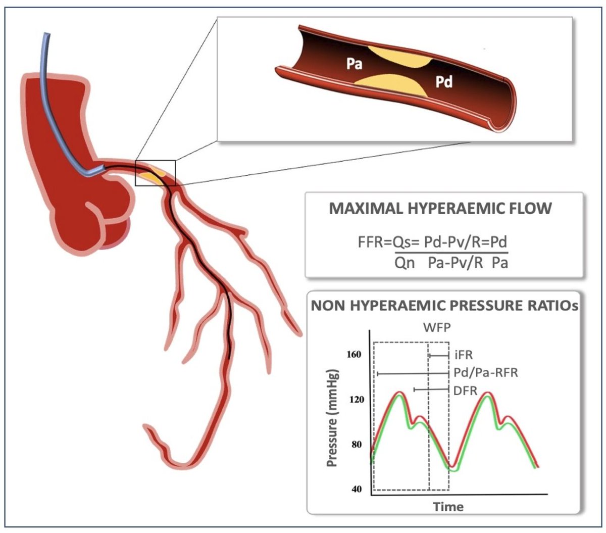 Heart_BMJ tweet media