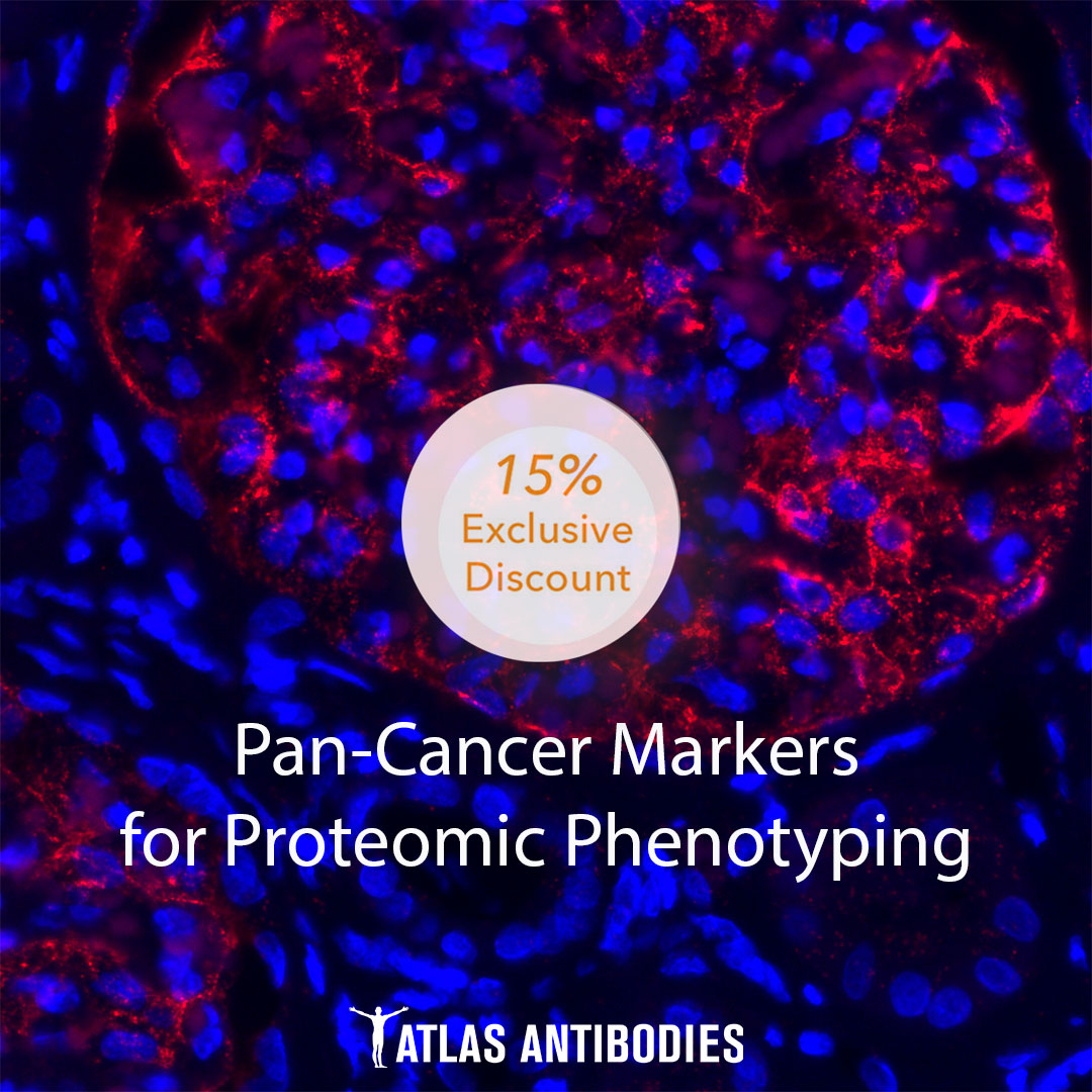 Atlas Antibodies offers over 300 primary antibodies validated on human cancer tissue and cells. - Additional Special Offer for PrecisA Monoclonals Bulk Order! Learn more: ow.ly/6xLr50R8erF #CancerResearch #Proteomicphenotyping #PanCancerMarkers #atlasantibodies