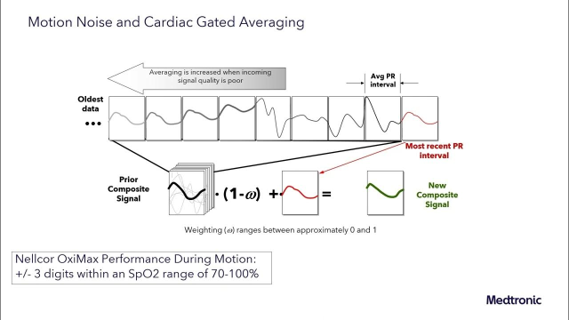 RayAstonMartin's tweet photo. #WorkingInMedTech: Did you know the Nellcor™ pulse oximetry system uses near-infrared light to measure oxygen in the blood? Check out the video. *Adjunctive technology, should not be used as sole basis for diagnosis/therapy #MedtronicEmployee https://t.co/w0Siv6179T https://t.co/eokbwcINjn
